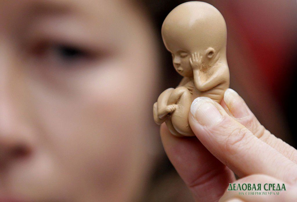 В Свердловской области сократилось число абортов